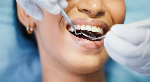 Best Dental Abscess Treatment in Cornelia, GA